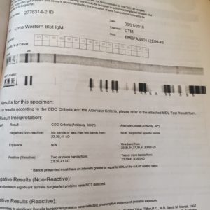 Western Blot Lyme Testing