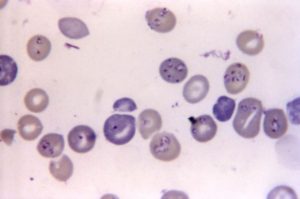 Babesia